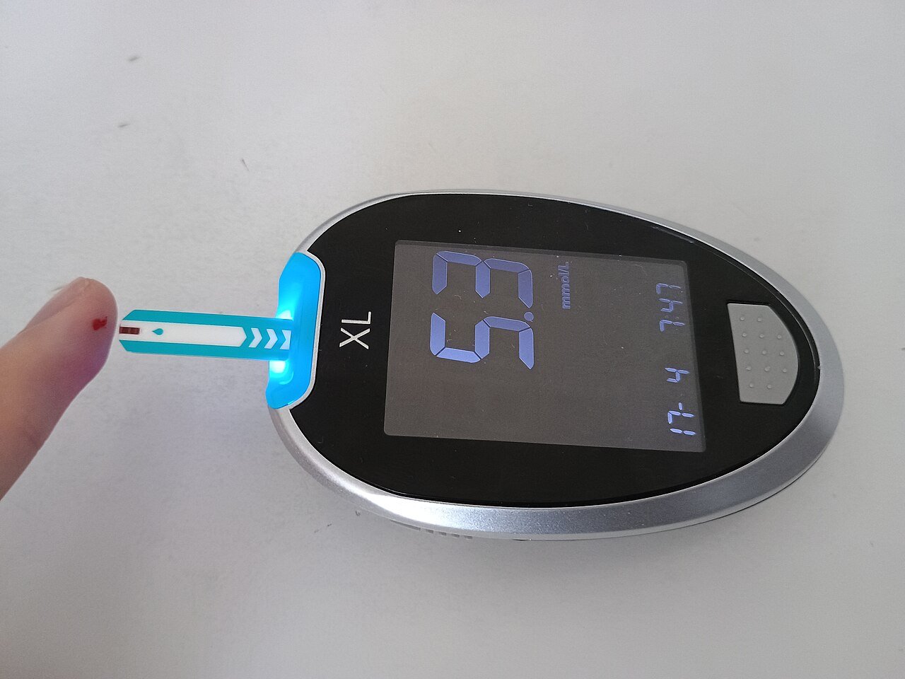 Mesure de la glycémie : une goutte de sang sur la bandelette affiche 5,3 mmol/l
